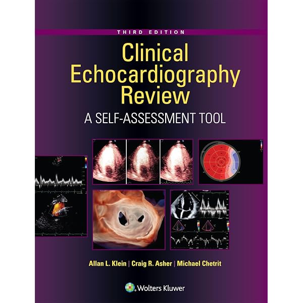 Braunwald's Heart Disease - E-Book: A Textbook of Cardiovascular